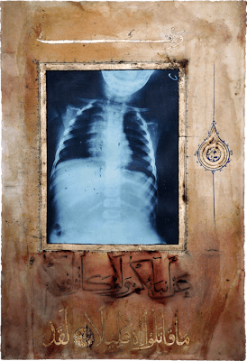 155cm 105cm Cardiac Illumination Illumination Torse II 2009 Ahmed Mater Gold lead tea pomegranate Dupont Chinese ink and offset X Ray print and mixed media on archival Arche paper 155 x 105 155cm 105cm