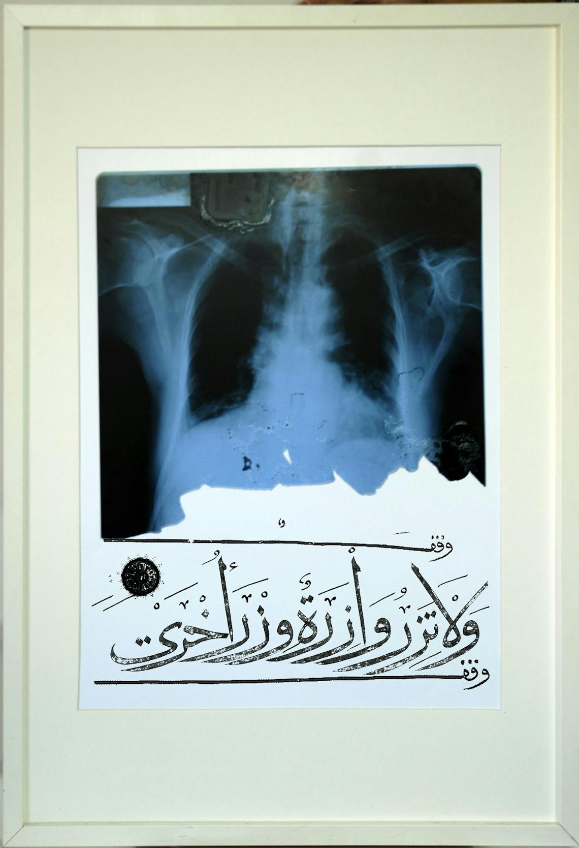 Untitled X Ray 2006 Offset Print and x ray on paper